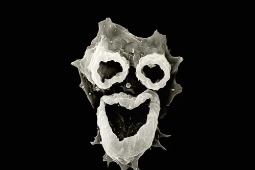 Amip ăn não - mắc bệnh là coi như... xong!