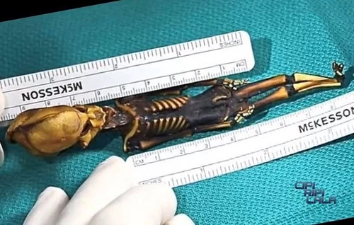 Bộ xương giống người ngoài hành tinh tiết lộ nhiều bí ẩn y học