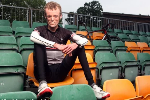 Căn bệnh chỉ 8 người mắc trên toàn thế giới