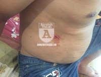 [ẢNH] Toàn cảnh vụ cảnh sát quật ngã đối tượng giang hồ cầm 2 dao nhọn cố thủ