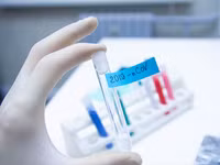 [ẢNH] Anh nghi ngờ chất lượng hàng triệu bộ kit xét nghiệm Covid-19 từ Trung Quốc