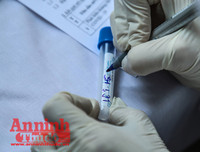 [ẢNH] Người dân mang cả hành lý, sẵn sàng cách ly khi đi test nhanh Covid-19 ở Hà Nội