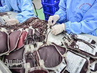 [ẢNH] Bác sỹ căng mình làm việc 12 tiếng 1 ngày trong bối cảnh thiếu máu do ảnh hưởng của dịch Corona