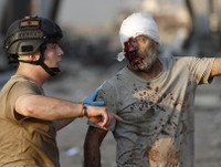 [ẢNH] Cận cảnh hiện trường vụ nổ kinh hoàng ở Lebanon làm 78 người chết