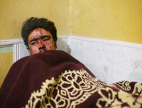 Cảnh điêu tàn xót xa ở Đông Ghouta vì chiến tranh tàn phá (2)