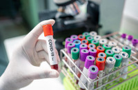 [ẢNH] Vì sao Belarus bất ngờ chỉ trích Nga dù đã nhận viện trợ y tế?