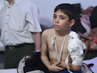 Những hình ảnh ít người biết bên trong bệnh viện ngầm ở Douma, Syria