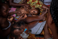 [ẢNH] Trẻ em chết đói trong cuộc khủng hoảng ở Cộng hòa Trung Phi