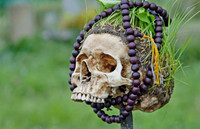 [ẢNH] 20 căn bệnh hiếm gặp nhất thế giới