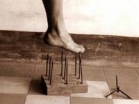 [ẢNH] 20 căn bệnh hiếm gặp nhất thế giới