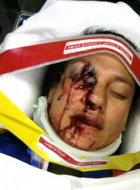 Australia thu hồi 2,3 triệu ô tô sử dụng túi khí không an toàn của hãng Takata