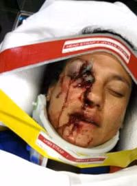 Australia thu hồi 2,3 triệu ô tô sử dụng túi khí không an toàn của hãng Takata