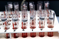 [ẢNH] Chấn động khi phát hiện 12.000 chai huyết tương nhiễm HIV