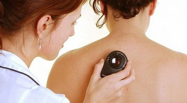 Những dấu hiệu ung thư dễ bị bỏ qua 