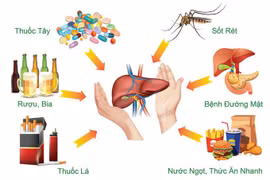 Thói quen hủy hoại gan mà nhiều người mắc 