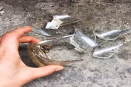 Cứu bé gái 16 tháng tuổi bị mảnh cốc thủy tinh đâm thủng bụng, ruột non chui ra ngoài