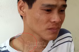 “Ngáo đá” vác dao nhảy xuống sông Hồng vì ảo giác có người đang rượt đuổi