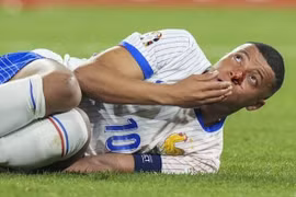 Mbappe gặp họa, nhập viện khẩn cấp trong chiến thắng của Pháp