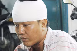 Đâm đồng nghiệp gần 30 nhát dao