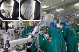 Cấp cứu thành công bệnh nhân chấn thương sọ não, gãy kín mâm chày