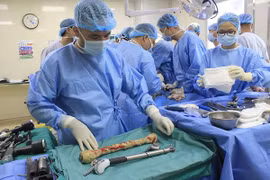 Người đàn ông đi lại được sau cuộc đại phẫu hiếm có trên thế giới