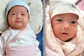 Hy hữu: Hai anh em sinh đôi chào đời cách nhau 5 tuần