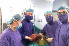Nữ bệnh nhân 49 tuổi ở Hà Nội có khối u thận khổng lồ nặng tới 2,8kg