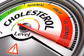 Nên kiểm tra cholesterol định kỳ