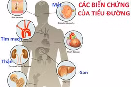 Khám và phát hiện sớm 10 bệnh lý nguy hiểm nhất thường gặp trong cuộc sống