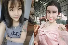 Người phẫu thuật thẩm mỹ có thể bị ngân hàng từ chối cho rút tiền?