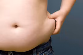 Người béo não nhanh già hơn