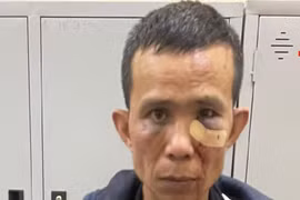 Kẻ có 6 tiền án lại 'ngựa quen đường cũ' đi trộm cắp tài sản