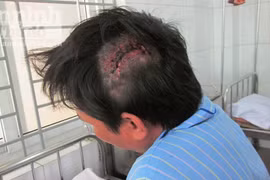 Côn đồ vô cớ vác kiếm chém người nhập viện