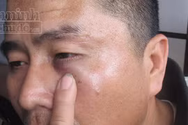 Tranh giành khách, gọi côn đồ đánh dằn mặt tài xế