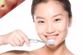 Bệnh từ miệng mà ra