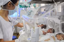 Một phương pháp hạn chế sinh non