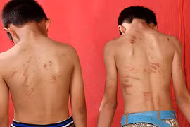 Bắt 7 đối tượng “cướp máu” trẻ em