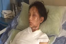 Phàn nàn chất lượng dịch vụ, khách hàng bị nhân viên trả thù bằng canh nóng