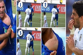 Cận cảnh pha cắn người thô thiển của “hung thần” Suarez