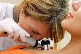 Cách điều trị mới cho dạng ung thư da hay gặp nhất