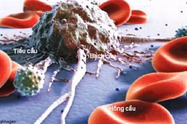 Lựa chọn mới cho trẻ bị bệnh bạch cầu khó điều trị