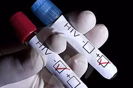 Bệnh nhân kiện bác sĩ vì tự ý xét nghiệm HIV