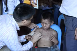  Làm rõ căn nguyên 2 em nhỏ mắc “bệnh lạ” tại Phú Thọ