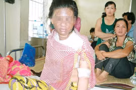 Vợ nằm võng, chồng dội cả nồi nước sôi lên người