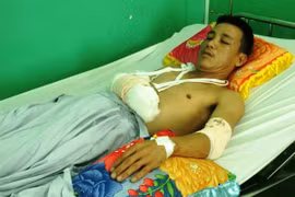 Nhắc nhở... đi tiểu bậy, chủ nhà bị giang hồ chém trọng thương