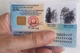 Sau khi phẫu thuật thẩm mỹ bắt buộc phải làm lại căn cước công dân?