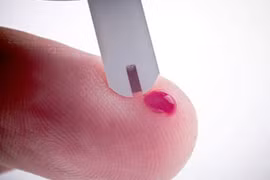 Có thể tự xét nghiệm HIV tại nhà