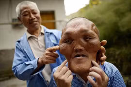 Người đàn ông có diện mạo như ngoài hành tinh