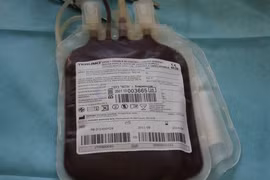 Châu Phi: Tràn lan "chợ đen" bán máu bệnh nhân Ebola sống sót