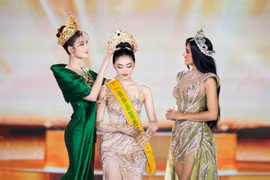 Hoa hậu Yến Nhi thẳng thắn chia sẻ về quyết định phẫu thuật thẩm mỹ